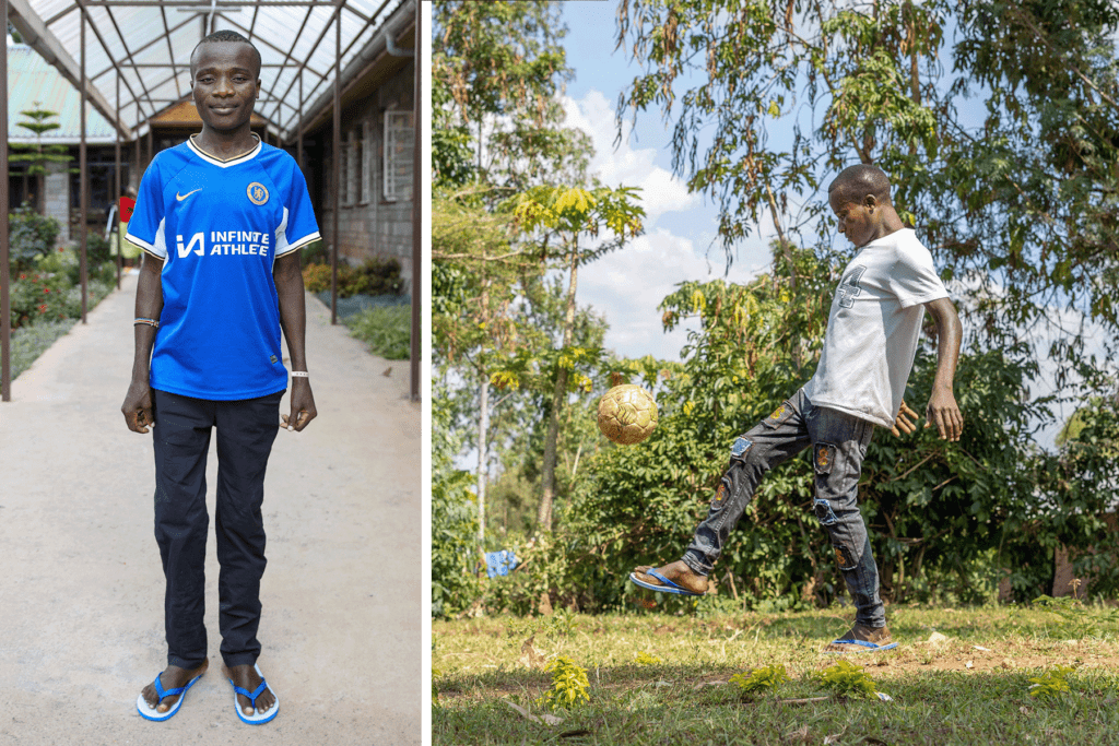 Bovin’s last day at CURE Kenya, after a complete transformation! (L) and Bovin back at home, finally playing footbal (R)